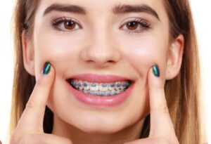 young lady received braces at her orthodontics appointment at lytle family dentistry 78052